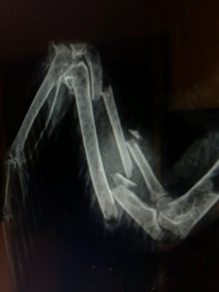 Radiograph showing a shattered pigeon wing